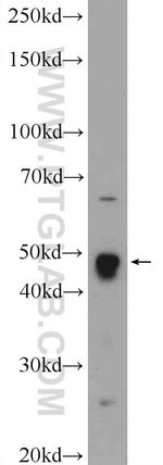 LYAR Antibody in Western Blot (WB)