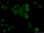 BRIP1 Antibody in Immunocytochemistry (ICC/IF)