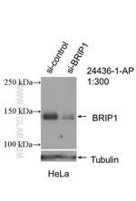 BRIP1 Antibody in Western Blot (WB)