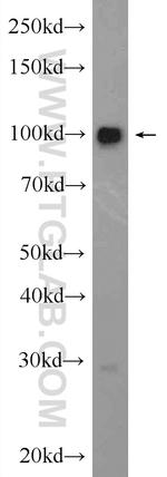 BRIP1 Antibody in Western Blot (WB)