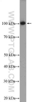 PPP1R10 Antibody in Western Blot (WB)