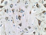 EPHA6 Antibody in Immunohistochemistry (Paraffin) (IHC (P))