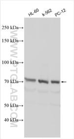 ABCG8 Antibody in Western Blot (WB)