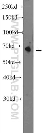 OTOP1 Antibody in Western Blot (WB)