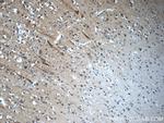 CEP44 Antibody in Immunohistochemistry (Paraffin) (IHC (P))