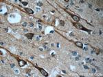CEP44 Antibody in Immunohistochemistry (Paraffin) (IHC (P))