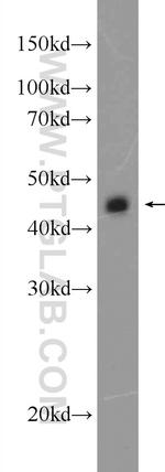 CEP44 Antibody in Western Blot (WB)