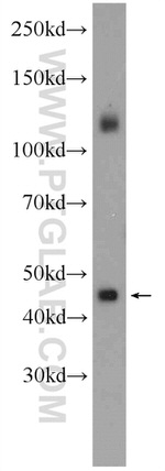 CEP44 Antibody in Western Blot (WB)