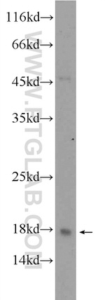 C10orf67 Antibody in Western Blot (WB)