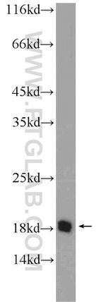 C10orf67 Antibody in Western Blot (WB)