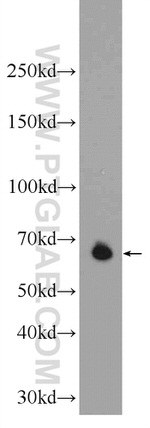 EXOSC9 Antibody in Western Blot (WB)