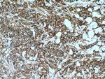 GEF-H1 Antibody in Immunohistochemistry (Paraffin) (IHC (P))