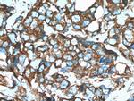 GEF-H1 Antibody in Immunohistochemistry (Paraffin) (IHC (P))