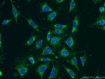 C1QBP Antibody in Immunocytochemistry (ICC/IF)