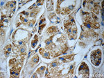 C1QBP Antibody in Immunohistochemistry (Paraffin) (IHC (P))