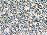 C1QBP Antibody in Immunohistochemistry (Paraffin) (IHC (P))