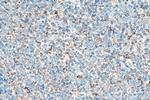 C1QBP Antibody in Immunohistochemistry (Paraffin) (IHC (P))