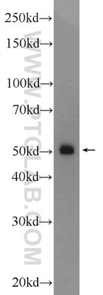 TMEM194A Antibody in Western Blot (WB)