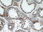 PRPF39 Antibody in Immunohistochemistry (Paraffin) (IHC (P))