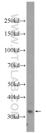 AMZ1 Antibody in Western Blot (WB)