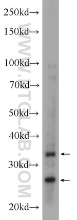 AMZ1 Antibody in Western Blot (WB)