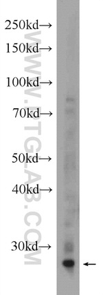 AMZ1 Antibody in Western Blot (WB)
