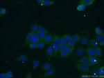 OTUD6A Antibody in Immunocytochemistry (ICC/IF)