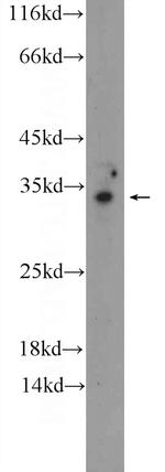 OTUD6A Antibody in Western Blot (WB)