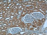 DNAH17 Antibody in Immunohistochemistry (Paraffin) (IHC (P))
