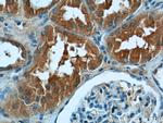 DNAH17 Antibody in Immunohistochemistry (Paraffin) (IHC (P))