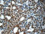 E2F7 Antibody in Immunohistochemistry (Paraffin) (IHC (P))