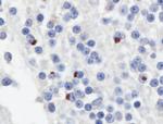 GP repeat Antibody in Immunohistochemistry (IHC)
