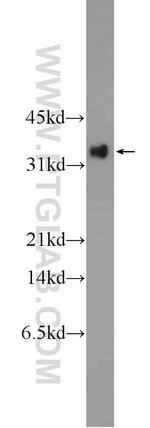 GP repeat Antibody in Western Blot (WB)