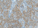 ARID4B Antibody in Immunohistochemistry (Paraffin) (IHC (P))