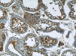 ARID4B Antibody in Immunohistochemistry (Paraffin) (IHC (P))