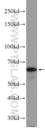 PPP2R3B Antibody in Western Blot (WB)