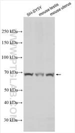 DCBLD1 Antibody in Western Blot (WB)