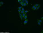VPS13B Antibody in Immunocytochemistry (ICC/IF)