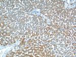 VPS13B Antibody in Immunohistochemistry (Paraffin) (IHC (P))