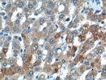 VPS13B Antibody in Immunohistochemistry (Paraffin) (IHC (P))