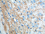 VPS13B Antibody in Immunohistochemistry (Paraffin) (IHC (P))