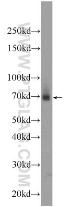ZNF512 Antibody in Western Blot (WB)