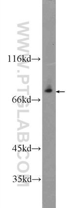 ZNF512 Antibody in Western Blot (WB)