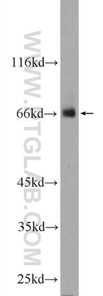 ZNF512 Antibody in Western Blot (WB)