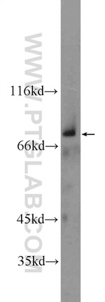 ZNF512 Antibody in Western Blot (WB)
