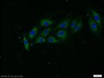 STXBP5 Antibody in Immunocytochemistry (ICC/IF)