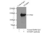 STXBP5 Antibody in Immunoprecipitation (IP)
