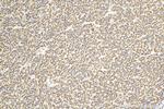 CPS1 Antibody in Immunohistochemistry (Paraffin) (IHC (P))