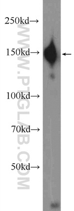 CPS1 Antibody in Western Blot (WB)