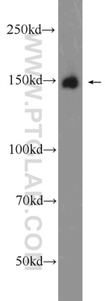 CPS1 Antibody in Western Blot (WB)